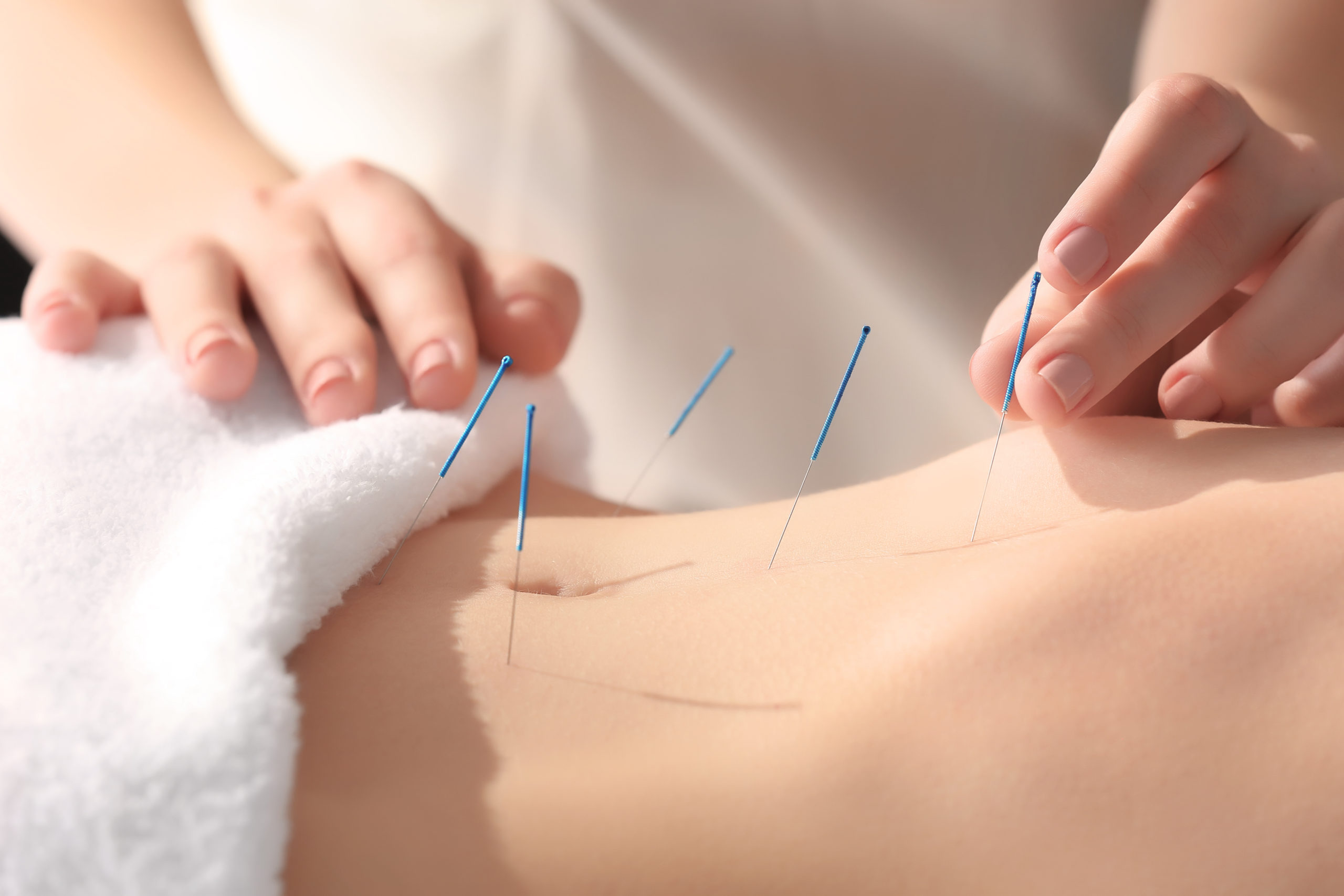 Does Acupuncture Aid in Digestion?