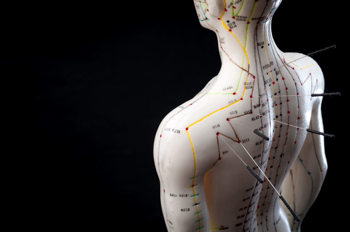 8 Things You Didn’t Know About Acupuncture