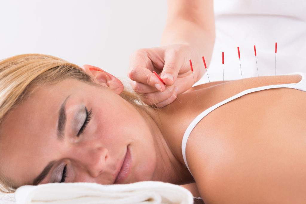 The Benefits of Combining Chiropractic Care and Acupuncture