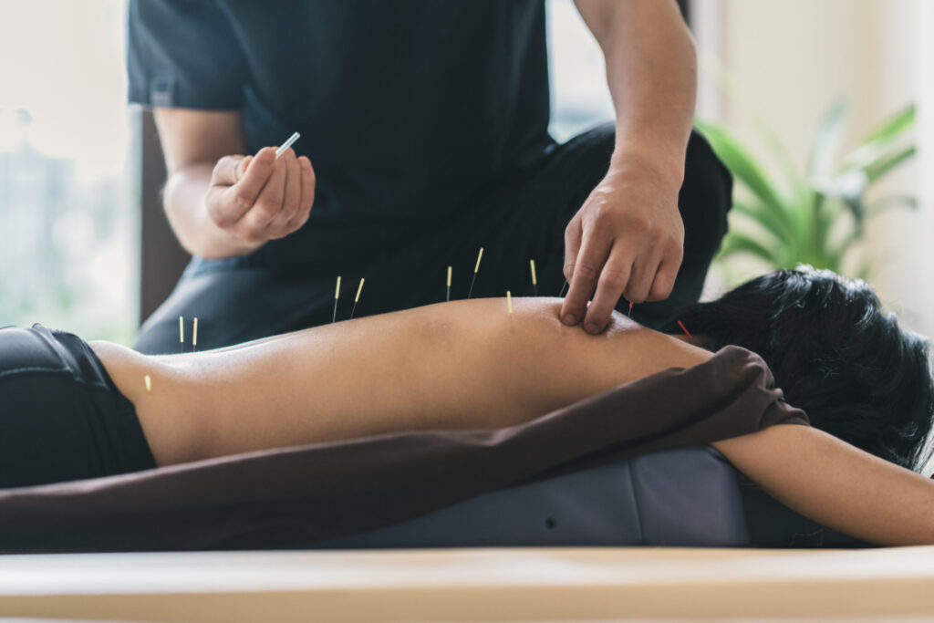 How Chiropractic Care, Acupuncture, and Massage Work Together