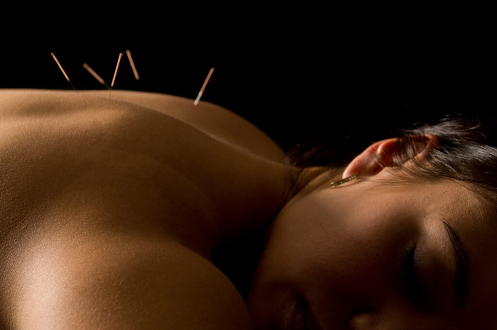 What to Expect at Your First Acupuncture Appointment